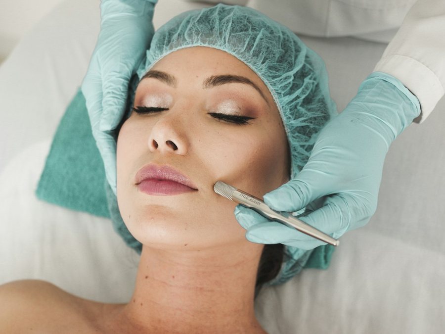 Dermaplaning en KALON Multiespacio Estético